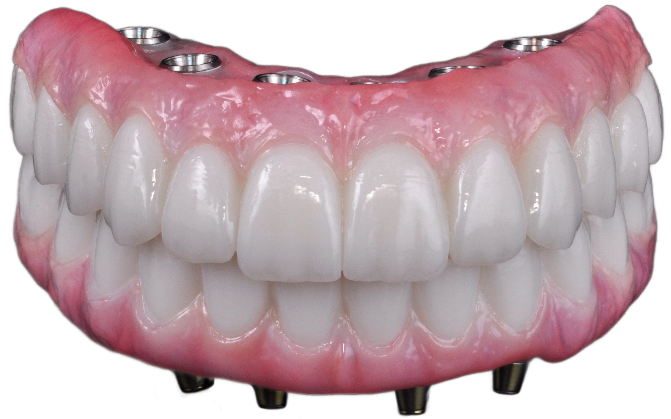 All-on-X zirconia full-arch prosthetic on multi-unit abutments