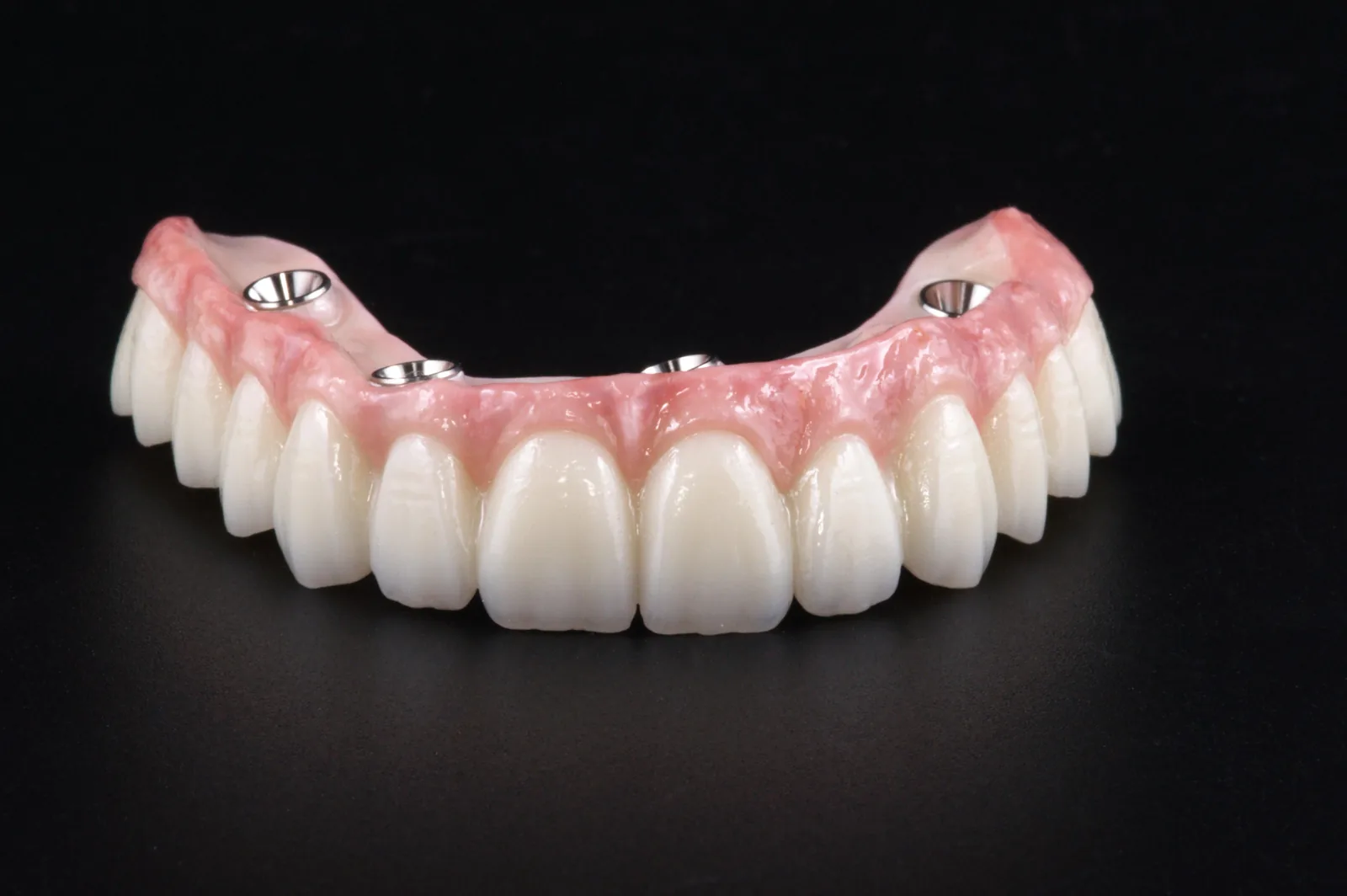 CeraZi layered zirconia upper full-arch All-on-X implant prosthesis