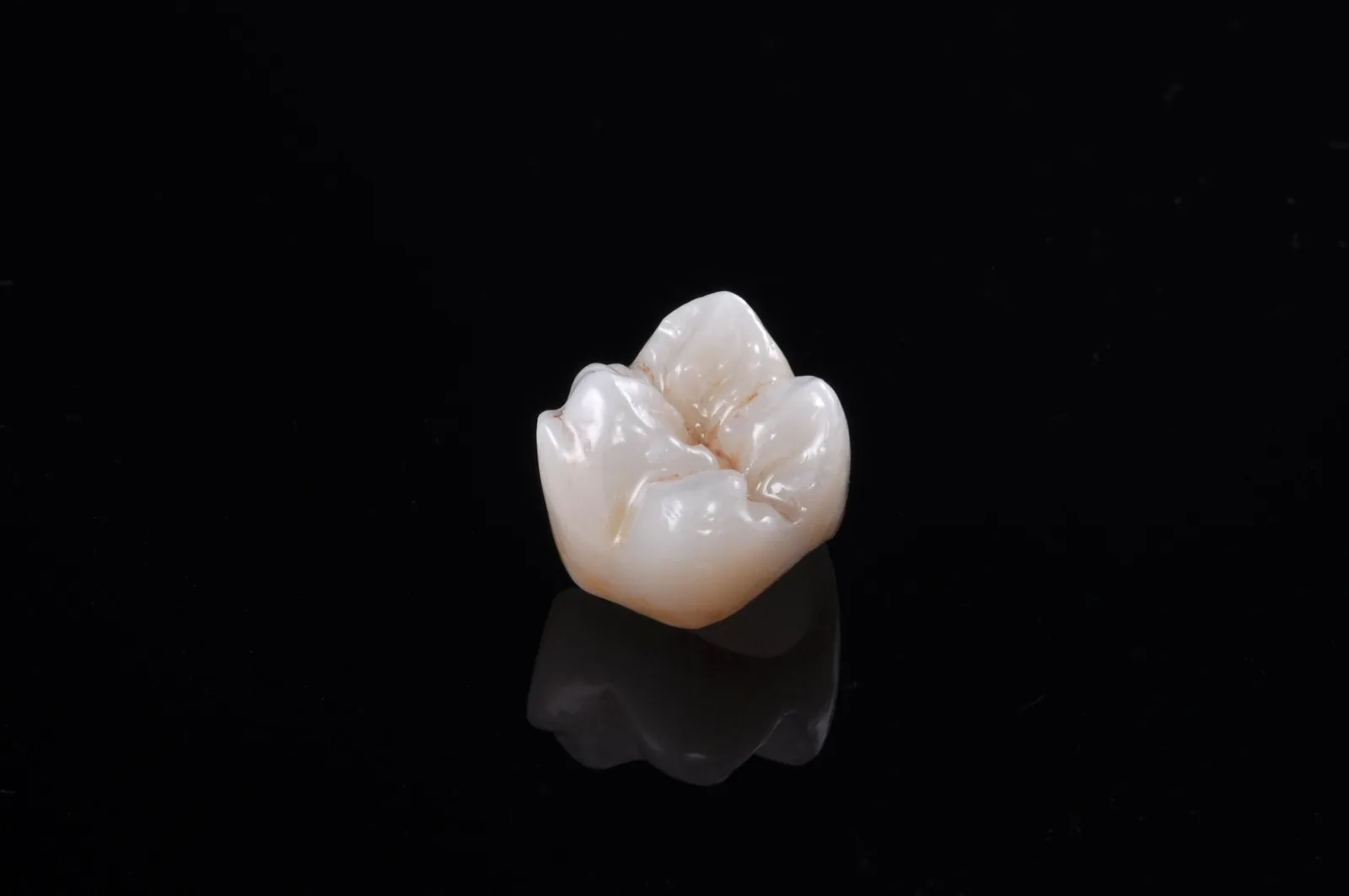 CeraZi layered zirconia posterior crown detail