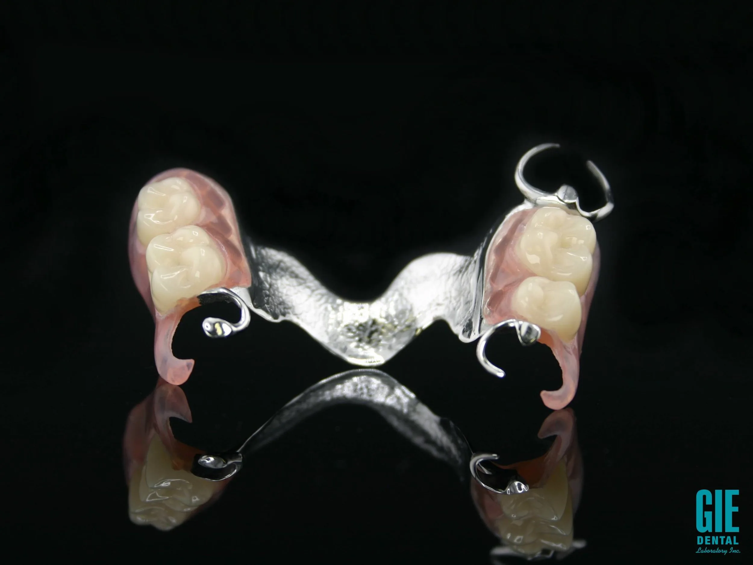 Cast chrome-cobalt partial denture framework