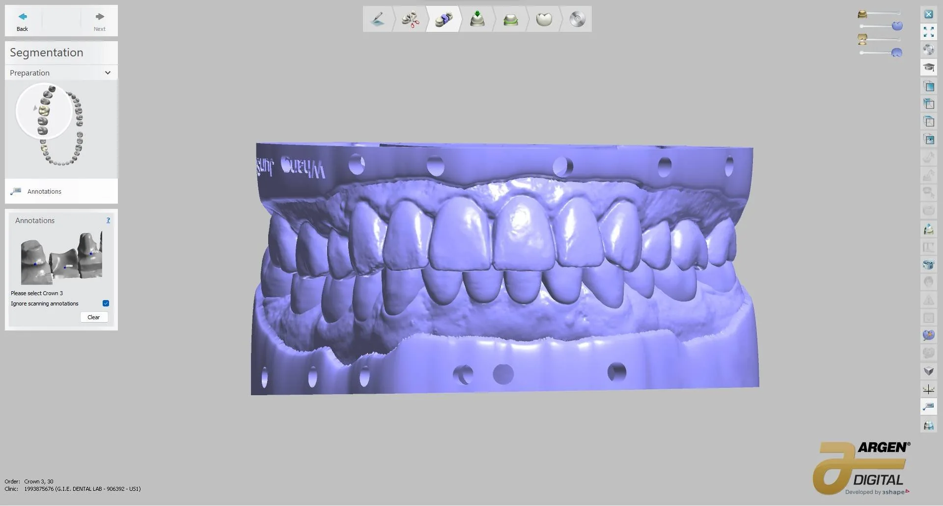 Digital diagnostic wax-up — after, completed design
