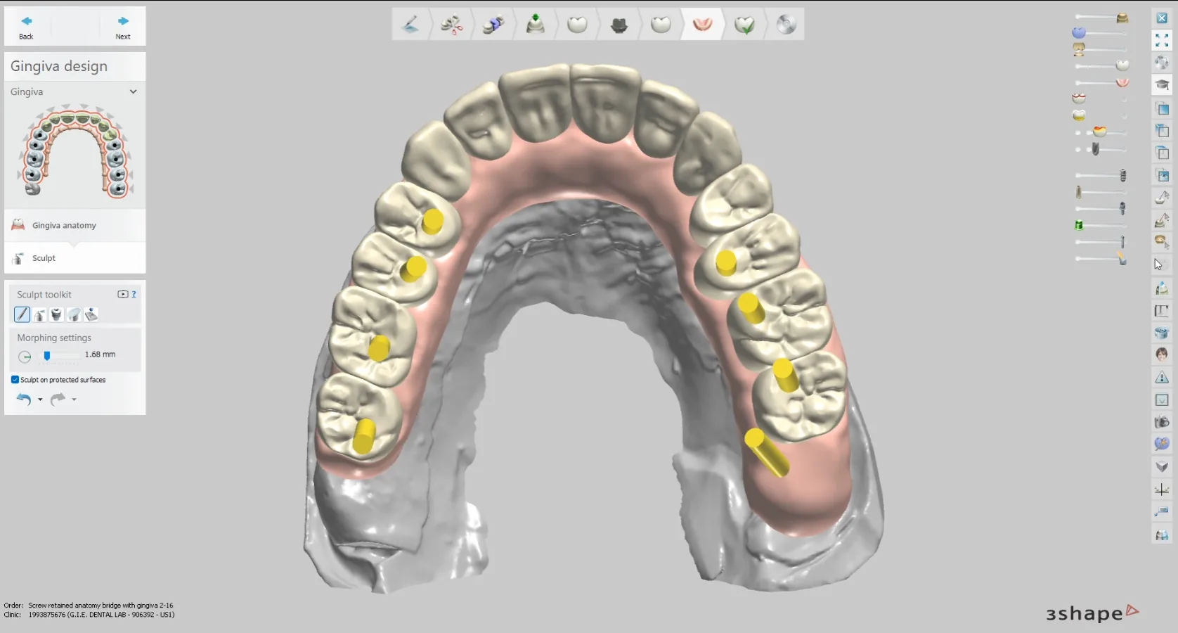 Intraoral scanner comparison