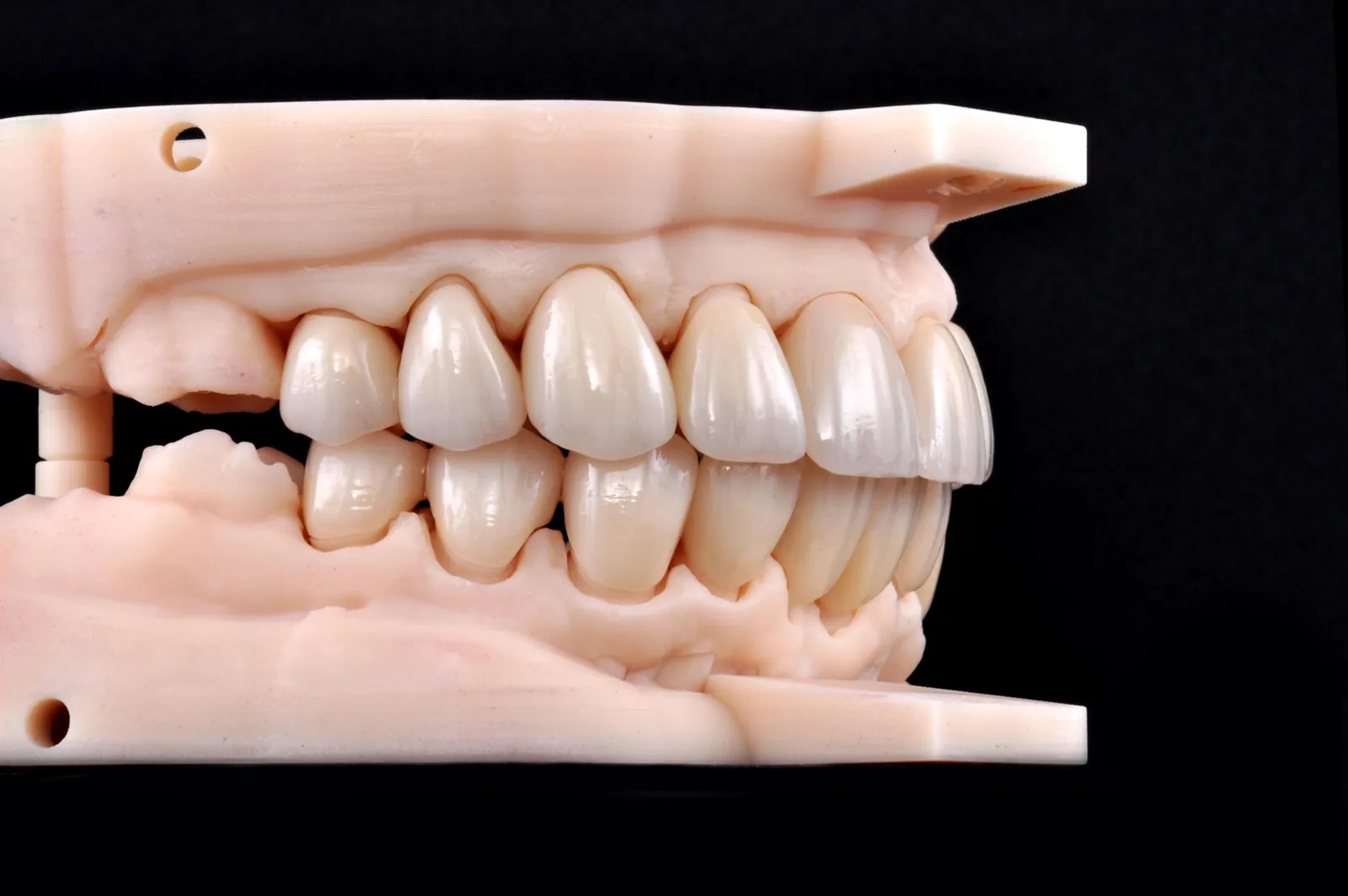 GIE PureZi 20-unit restoration — angled view