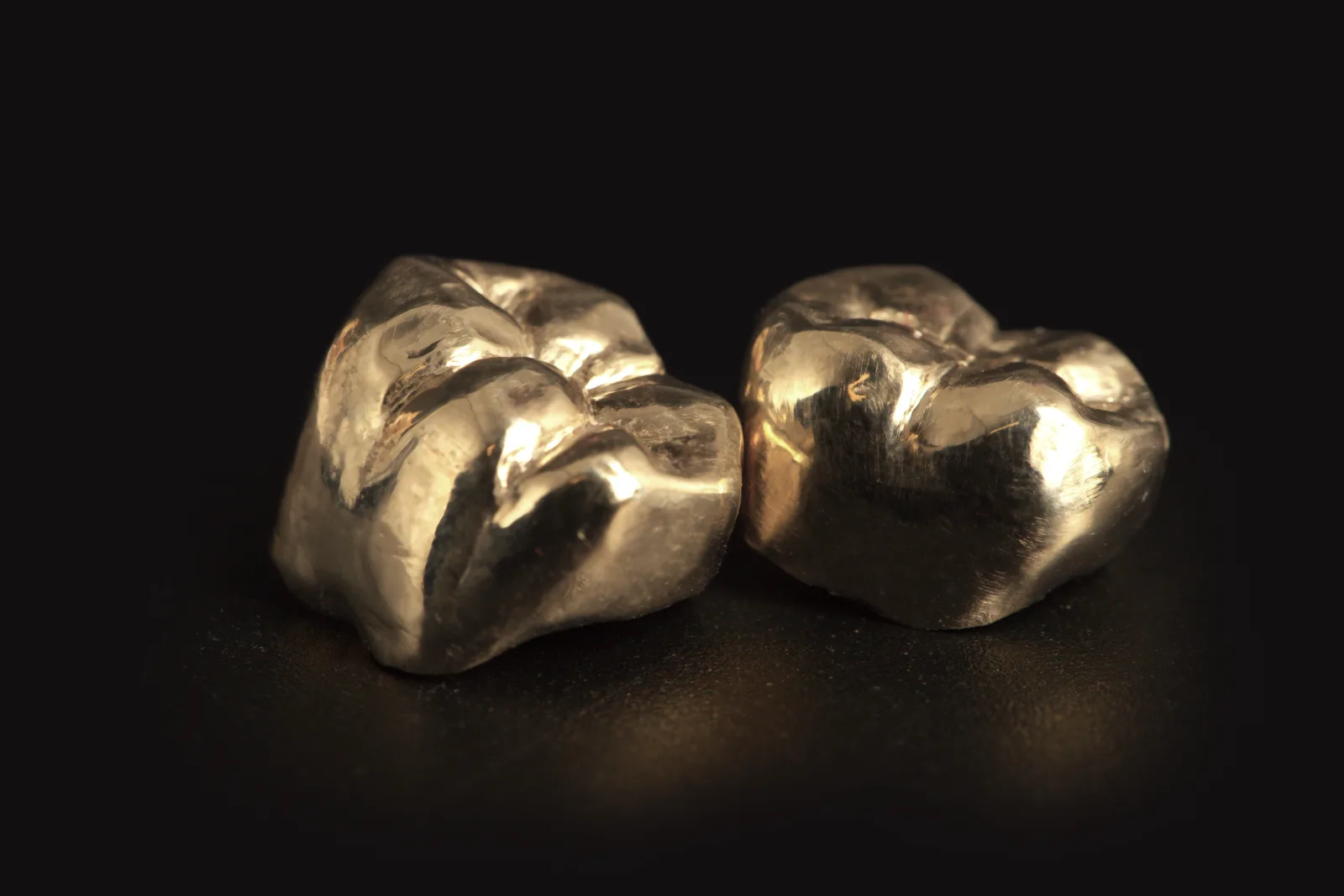 Full cast yellow gold crowns