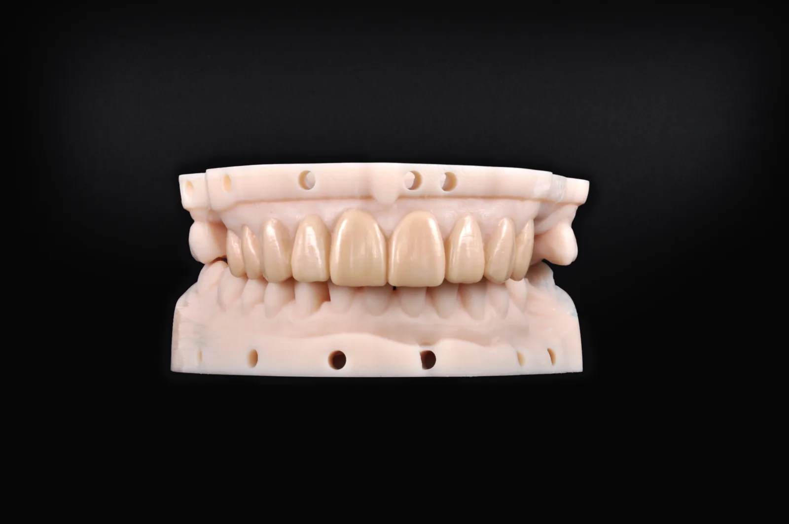 Completed upper diagnostic wax-up ready for patient presentation